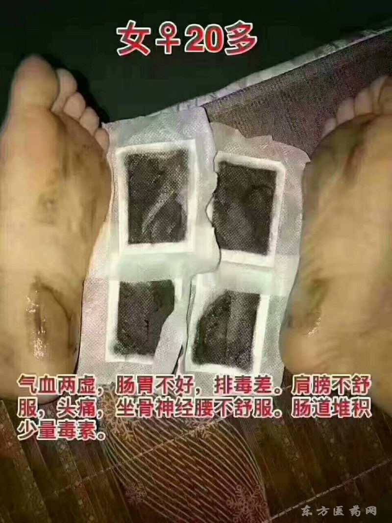 大今美穴位贴敷治疗贴