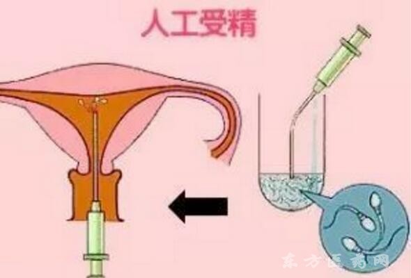 什么情况做试管三代