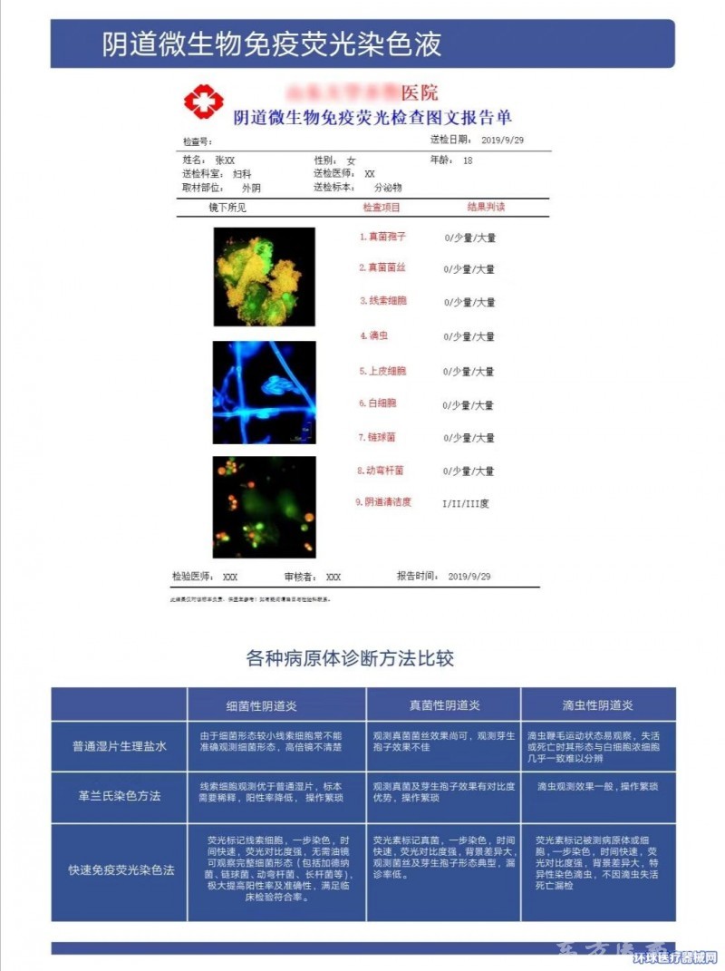 阴道微生物免疫荧光染色液,阴道分泌物检测