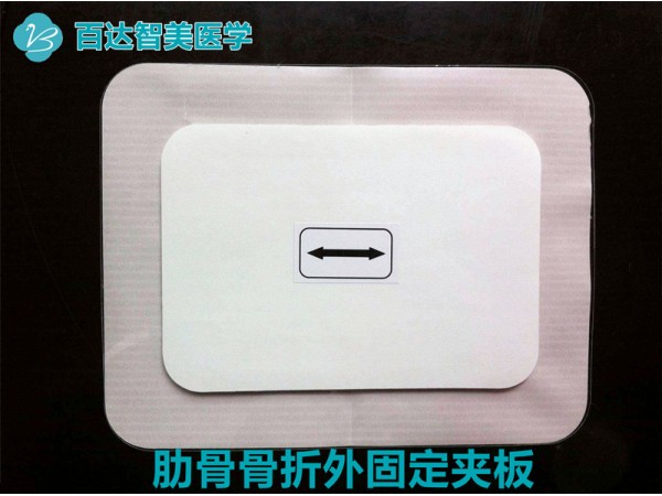 肋骨（胸骨）固定板（武汉百达智美医学）产品优势和操作使用特点