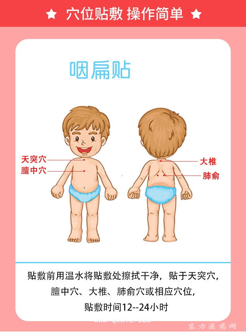 小儿儿童咽扁贴批发代理定制定做医院诊所OEM