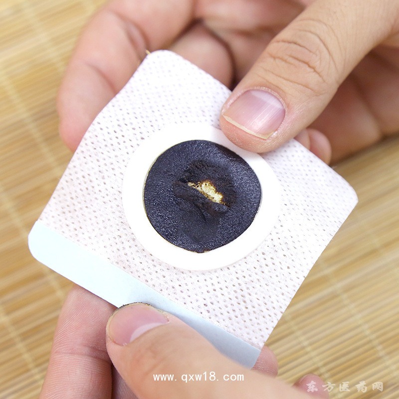 小儿穴位贴药泥贴企业中标挂网原头昌吉爱