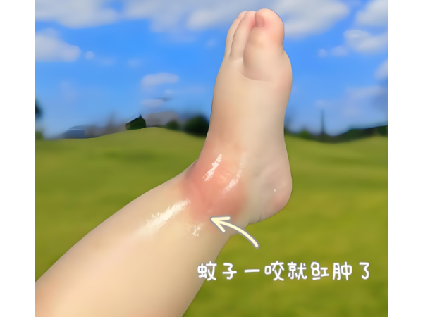 驱蚊液贴牌代工防蚊喷雾液儿童孕妇可用驱蚊液OEM贴牌厂家代工
