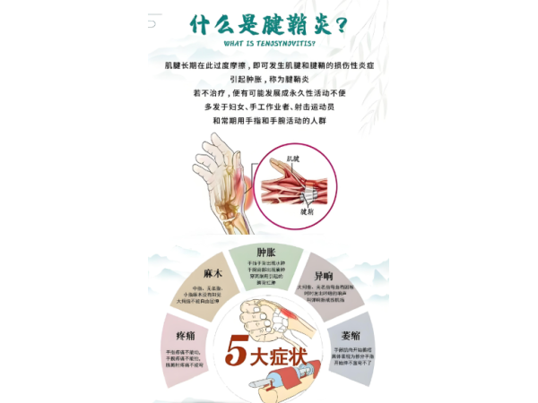 腱鞘贴OEM贴牌腱鞘炎止痛贴厂家肌腱炎贴手腕腱鞘炎贴手指腱鞘炎贴