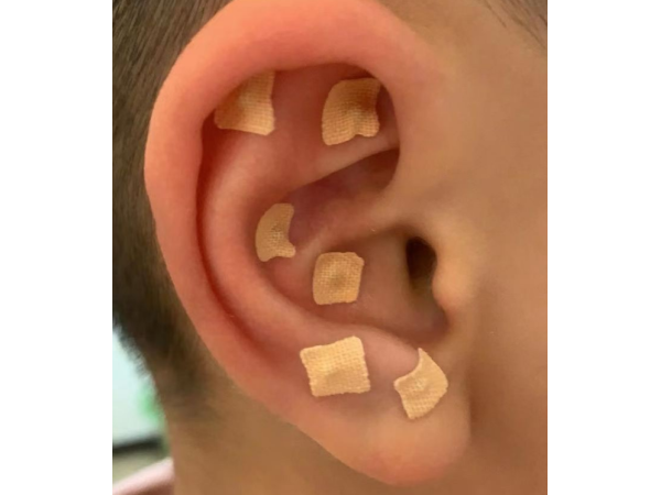 耳穴贴 耳朵不适贴牌定制