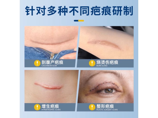 医用硅凝胶疤痕贴可重复用2mm厚剖腹产术后疤痕烧烫伤疤痕修复贴